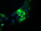 Thromboxane A Synthase 1 antibody, TA501379, Origene, Immunofluorescence image 
