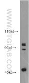 VPS52 Subunit Of GARP Complex antibody, 11662-2-AP, Proteintech Group, Western Blot image 