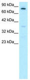 Forkhead Box E3 antibody, TA330241, Origene, Western Blot image 