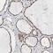 Male-specific lethal 2 homolog antibody, NBP1-83853, Novus Biologicals, Immunohistochemistry paraffin image 