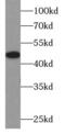 Solute carrier family 2, facilitated glucose transporter member 1 antibody, FNab09873, FineTest, Western Blot image 