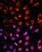 RAB7A, Member RAS Oncogene Family antibody, 14-627, ProSci, Immunofluorescence image 