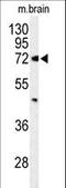 ATP Binding Cassette Subfamily D Member 2 antibody, LS-C155856, Lifespan Biosciences, Western Blot image 