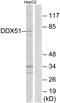 DEAD-Box Helicase 51 antibody, PA5-39042, Invitrogen Antibodies, Western Blot image 