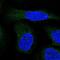 ALG9 Alpha-1,2-Mannosyltransferase antibody, NBP1-90191, Novus Biologicals, Immunocytochemistry image 