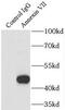 Annexin A7 antibody, FNab00439, FineTest, Immunoprecipitation image 