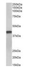 Troponin T2, Cardiac Type antibody, orb233666, Biorbyt, Western Blot image 