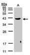 Pleckstrin antibody, orb73581, Biorbyt, Western Blot image 