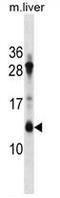 ATP synthase lipid-binding protein, mitochondrial antibody, AP50300PU-N, Origene, Western Blot image 