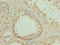 Down syndrome critical region protein 9 antibody, LS-C396300, Lifespan Biosciences, Immunohistochemistry paraffin image 