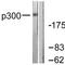 E1A Binding Protein P300 antibody, TA313819, Origene, Western Blot image 