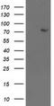 LIM domain kinase 1 antibody, LS-C172994, Lifespan Biosciences, Western Blot image 