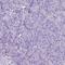 Acetylcholine Receptor antibody, HPA014101, Atlas Antibodies, Immunohistochemistry paraffin image 