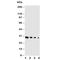 Glial Cell Derived Neurotrophic Factor antibody, R30537, NSJ Bioreagents, Western Blot image 