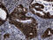 DnaJ homolog subfamily B member 6 antibody, M03290, Boster Biological Technology, Immunohistochemistry paraffin image 