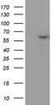 Dystrobrevin Alpha antibody, CF502164, Origene, Western Blot image 