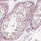 Spermatogenesis Associated 6 Like antibody, NBP1-84648, Novus Biologicals, Immunohistochemistry paraffin image 