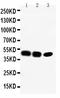 C-C Motif Chemokine Receptor 6 antibody, PA1201, Boster Biological Technology, Western Blot image 