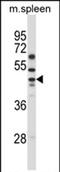 Solute Carrier Family 30 Member 6 antibody, PA5-71831, Invitrogen Antibodies, Western Blot image 