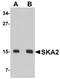 Spindle And Kinetochore Associated Complex Subunit 2 antibody, NBP1-76312, Novus Biologicals, Western Blot image 