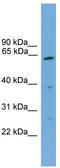 Proteasome 26S Subunit, Non-ATPase 3 antibody, TA342176, Origene, Western Blot image 