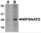 Nipsnap Homolog 2 antibody, 4953, ProSci, Western Blot image 