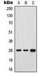 Folate Receptor Gamma antibody, GTX55857, GeneTex, Western Blot image 