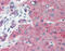 Claudin 1 antibody, 51-045, ProSci, Immunohistochemistry paraffin image 