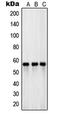 Excitatory amino acid transporter 3 antibody, LS-C352847, Lifespan Biosciences, Western Blot image 