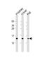 NADH:Ubiquinone Oxidoreductase Subunit S5 antibody, M04093, Boster Biological Technology, Western Blot image 