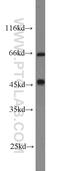 Aspartyl-tRNA synthetase, mitochondrial antibody, 13807-1-AP, Proteintech Group, Western Blot image 