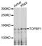 DNA Topoisomerase II Binding Protein 1 antibody, LS-C747670, Lifespan Biosciences, Western Blot image 
