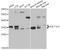 Sulfotransferase Family 1A Member 3 antibody, A03804, Boster Biological Technology, Western Blot image 