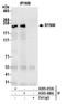 Synemin antibody, A305-413A, Bethyl Labs, Immunoprecipitation image 