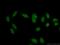 RNA Binding Motif Protein 6 antibody, 14360-1-AP, Proteintech Group, Immunofluorescence image 