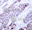 ATF4 antibody, AP0309, ABclonal Technology, Immunohistochemistry paraffin image 