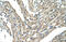 F-Box And Leucine Rich Repeat Protein 5 antibody, ARP43104_T100, Aviva Systems Biology, Immunohistochemistry frozen image 