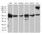 Transducin Beta Like 1 X-Linked Receptor 1 antibody, LS-C792897, Lifespan Biosciences, Western Blot image 