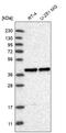 Mitochondrial Fission Regulator 1 Like antibody, HPA027124, Atlas Antibodies, Western Blot image 