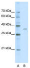 Zinc Finger And BTB Domain Containing 26 antibody, TA339522, Origene, Western Blot image 