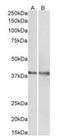 Isocitrate dehydrogenase [NAD] subunit gamma, mitochondrial antibody, orb22492, Biorbyt, Western Blot image 
