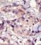 Platelet Derived Growth Factor Receptor Alpha antibody, AP14390PU-N, Origene, Immunohistochemistry frozen image 