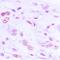 Bruton Tyrosine Kinase antibody, orb216040, Biorbyt, Immunohistochemistry paraffin image 
