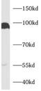 Axin-2 antibody, FNab00753, FineTest, Western Blot image 