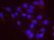 Small VCP/p97-interacting protein antibody, NB100-1557, Novus Biologicals, Proximity Ligation Assay image 