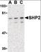 Protein Tyrosine Phosphatase Non-Receptor Type 11 antibody, orb87347, Biorbyt, Western Blot image 
