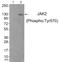 Janus Kinase 2 antibody, AP55701PU-N, Origene, Western Blot image 