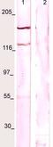 FMS antibody, TA354662, Origene, Western Blot image 