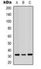Voltage Dependent Anion Channel 1 antibody, orb319069, Biorbyt, Western Blot image 