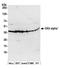 Casein Kinase 2 Alpha 1 antibody, A300-199A, Bethyl Labs, Western Blot image 